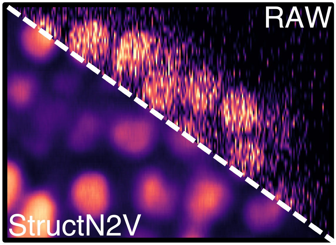 CSBD How A Blind spot Lets Us See More